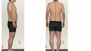 Rolfing Structural Integration with Yielding embodiment
