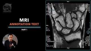 🧠 MRI – Annotation Text – Part 1