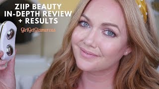 ZIIP Beauty Review Before + After | My 6 Month Results (new discount code!)