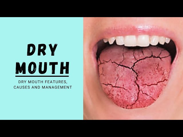 Dry Mouth | Xerostomia - YouTube Dry Mouth | Xerostomia - YouTube