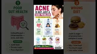 Acne isn’t just skin deep Fix gut, sleep &amp; diet#AcneTips #HealthySkin #DoctorAdvice  #Skincare