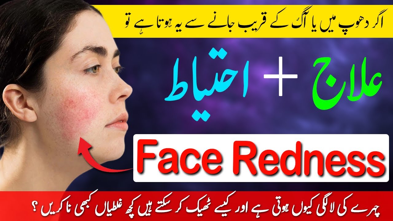 چہرے کی لالگی کیوں ہوتی ہے اور علاج کیسے کریں - Face Redness