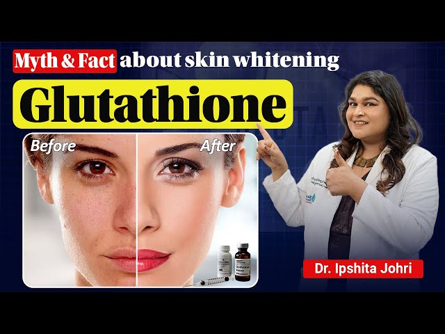 are glutathione tablets safe Amazon.com: NOW Foods Supplements, Glutathione 500 mg, With Milk Thistle  Extract & Alpha Lipoic Acid, Free Radical Neutralizer*, 60 Veg Capsules :  Health & Household
