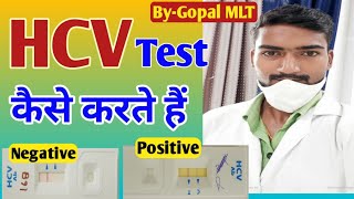Hcv Test Kaise Karte Haihcv Test In Hindi By Gopal Mlt