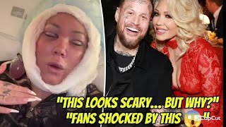 Bunnie Xo Shocks Fans With Brutal Facelift Reveal – “I Look Scary!” #celebritynews #bunnie