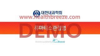[Demo] a0140aako_[The Korean Association of Internal Medicine] Rheumatoid Arthritis