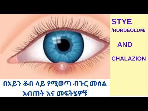 ቪዲዮ: ከክረምት በላይ የሚወጣ ፔንታስ፡በክረምት ወቅት በፔንታስ ምን እንደሚደረግ