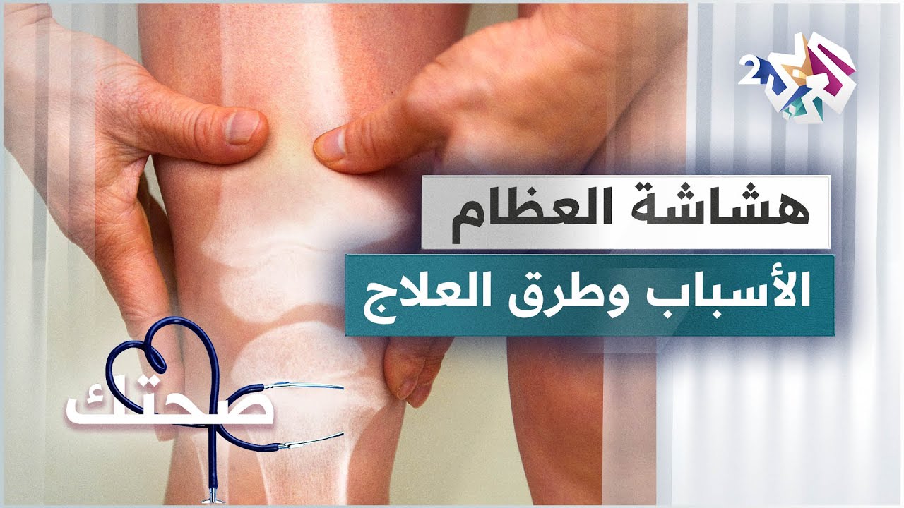 مرض هشاشة العظام .. ما هي أسبابه وطرق علاجه؟