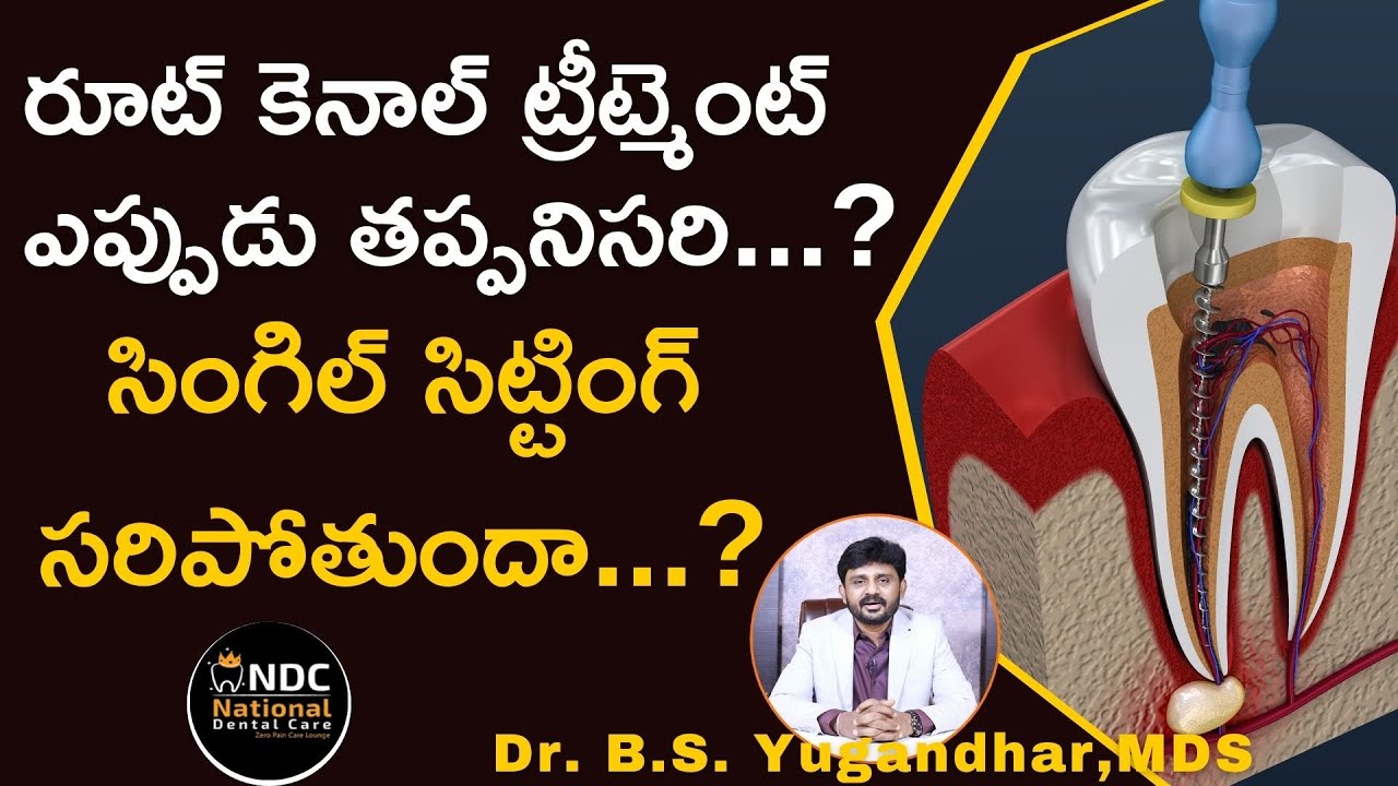 రూట్‌ కెనాల్‌ చికిత్స ఎప్పుడు, ఎందుకు చేస్తారు...? | When Root Canal Is Needed | Dr Yugandhar | NDC
