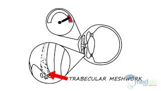 Ophthalmology – Chronic Visual Loss: By Sherif El-Defrawy M.D.
