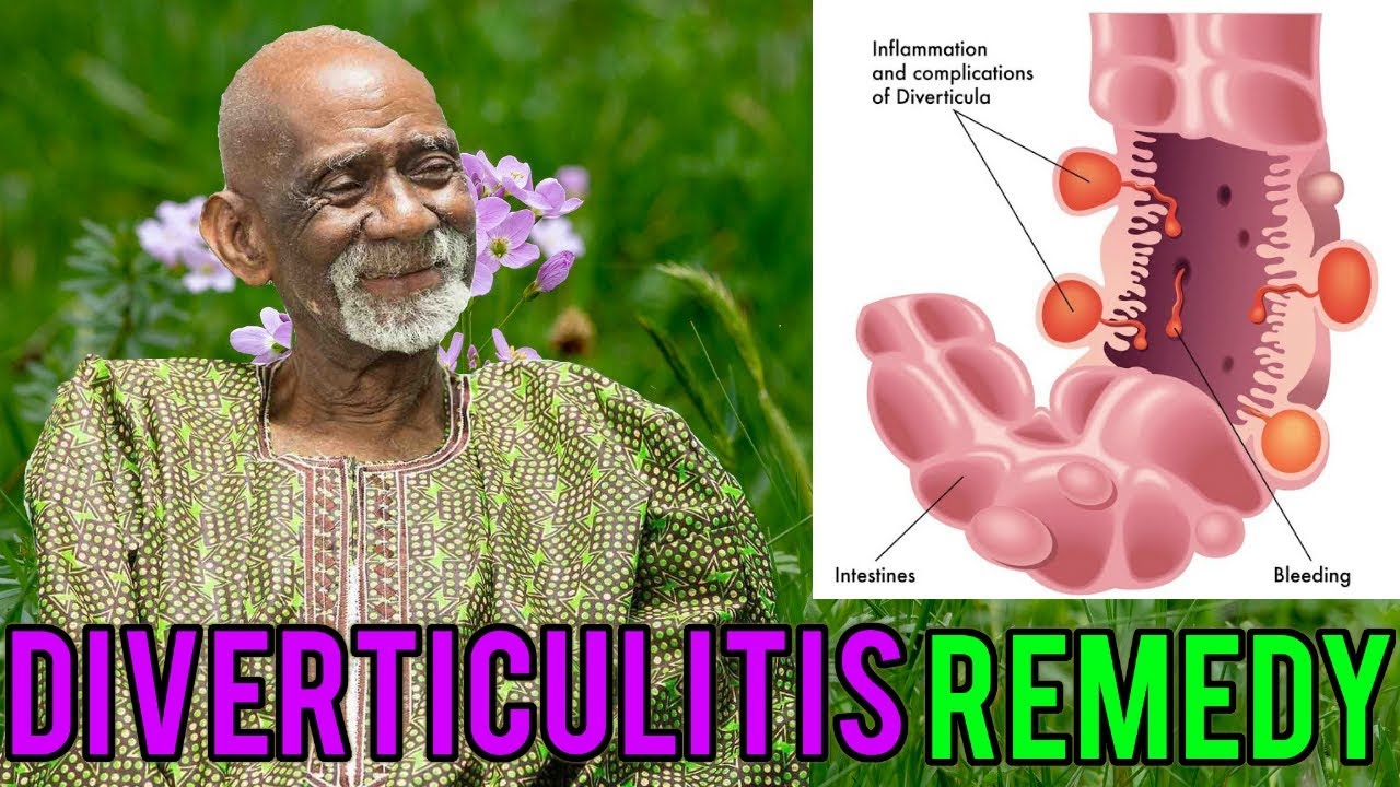 remedies for uti Dr Sebi - Natural Herbal Remedy For Diverticulitis