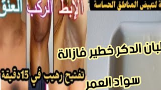 معجزة ربانية كتقضي على سواد العمر/وصفة مجربة وناجحة/سواد المنطقة الحساسة/ابط/ركب/عنق/نتيجةفاول مرة