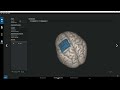 gtec suite 2020 iEEG Electrode Grid Placement