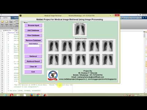 Medical Image Retrieval Using Matlab
