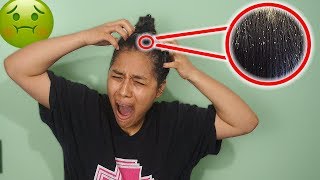 I WENT TO THE WORST HAIR SALON AND GOT LICE!