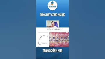 Dùng Dây Cong Ngược Trong Chỉnh Nha I Học Viện Nha Khoa Việt Nam #hocchinhnha #bedaycung