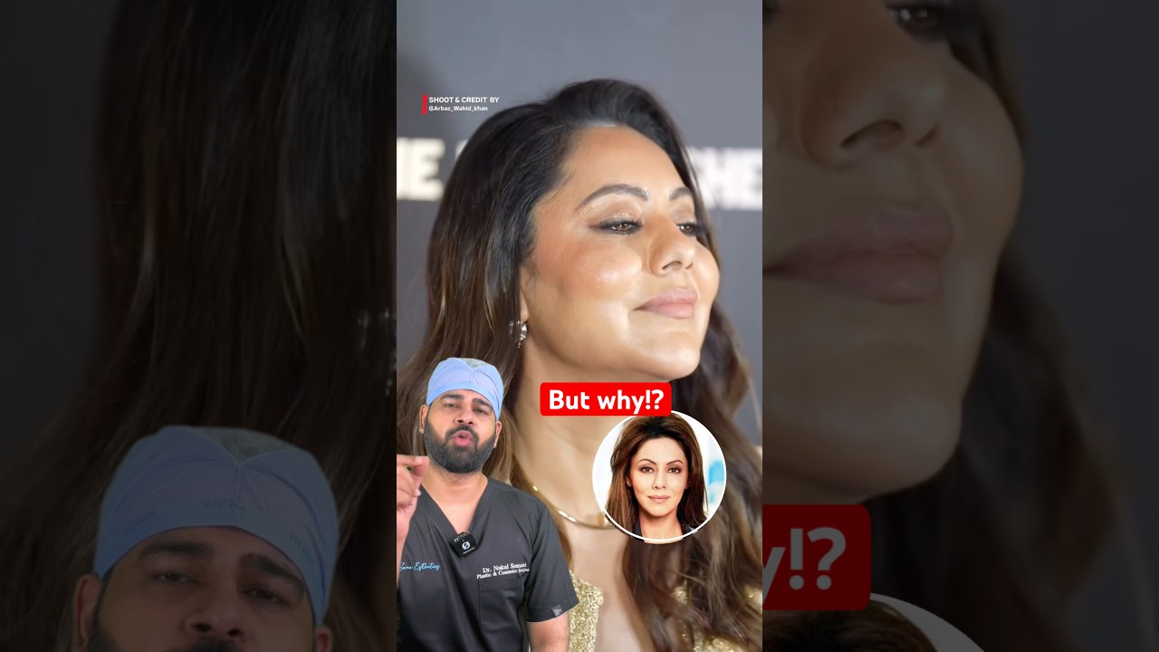 The overfilled fillers in Bollywood. But why?      -Dr. Nakul Somani (Cosmetic & Plastic Surgeon)