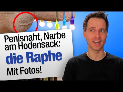 Penisnaht, Narbe am Sack, Raphe | jungsfragen.de - Penisnaht, Narbe am Sack, Raphe | jungsfragen.de