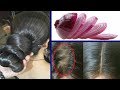 Surprising Hair Grow Long and Stop Hair Fall With Onion !! Super Fast Hair Growth Challenge!