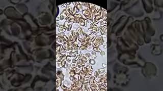 Covid 19 blood under the microscope 🔬 #reels #microscope #viral #covid19 #covid #coronavirus #lab