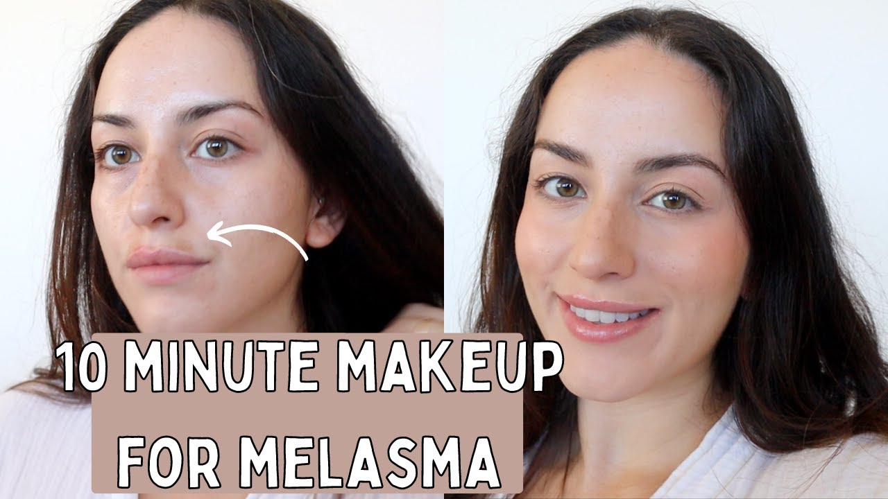 Ligner Høj eksponering stege how to cover up melasma on upper lip with natural makeup (tutorial) -  YouTube