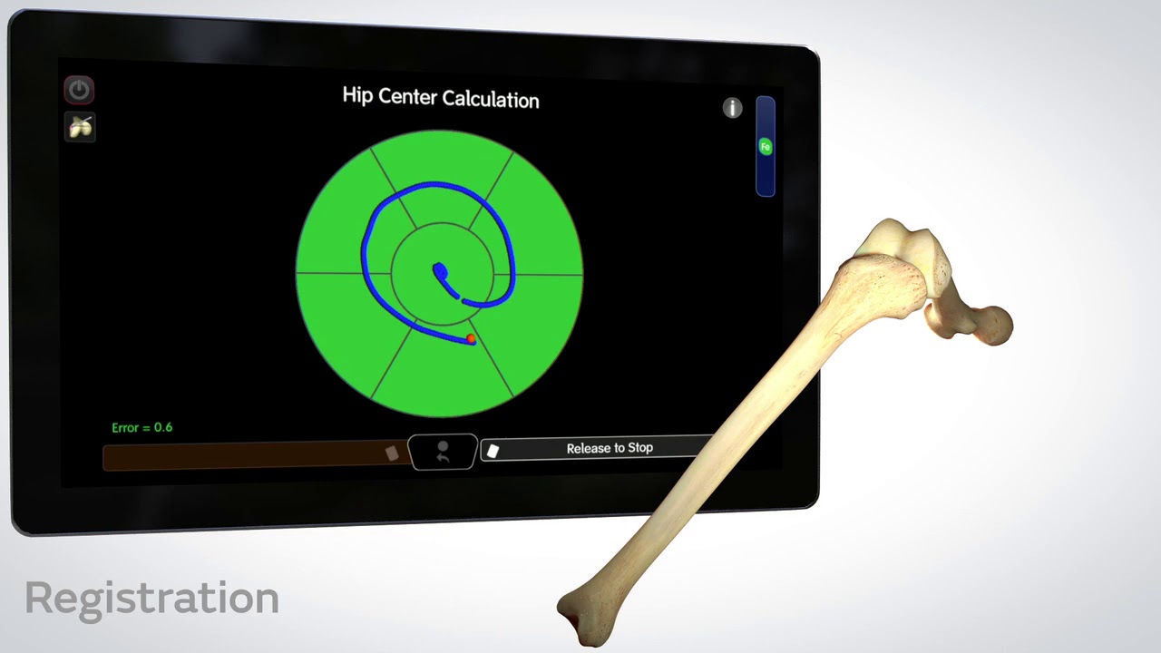 CORI Surgical System Smith+Nephew Corporate YouTube
