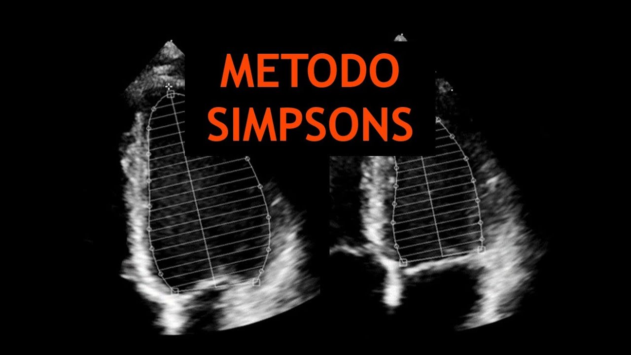 Metodo Simpsons Ecocardiografia YouTube Metodo Simpsons Ecocardiografia YouTube