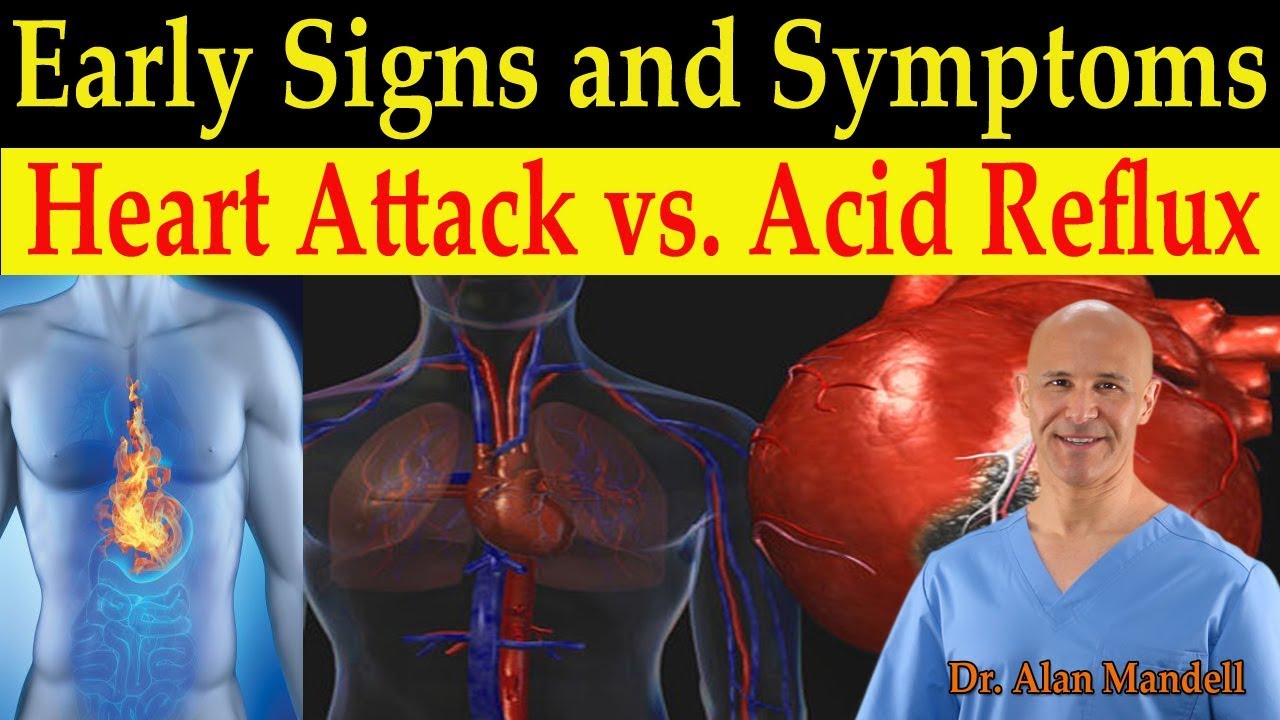 Identifying Heart Attack vs. Acid Reflux (GERD) Early ...