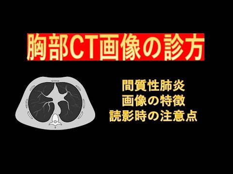 胸部CT線画像の診方-間質性肺炎の特徴と読影時の注意点- - YouTube