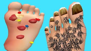 Foot Clinic-Gameplay Walkthrough-All Levels (IOS,Android) screenshot 1