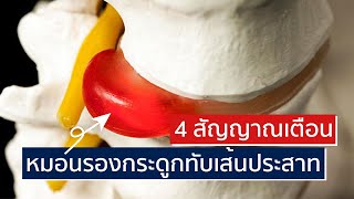 4 อาการสำคัญ ! หมอนรองกระดูกสันหลังทับเส้นประสาท | EasyDoc Family Talk EP.8