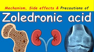 Zoledronic Acid Injection Reclast - Side Effects, Precautions & Uses