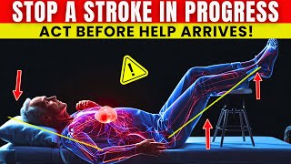 Over 60? Do THIS Before Help Arrives — The 3 Minute Trick to Stop a Stroke!