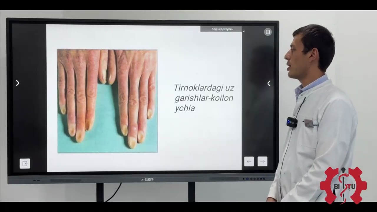 Temir tanqisligi anemiyasi. Jalilov J | 2-3-kurs Davolash ishi