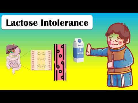 Lactose Intolerance - Types, Causes, Pathophysiology, Signs & Symptoms, And Treatment