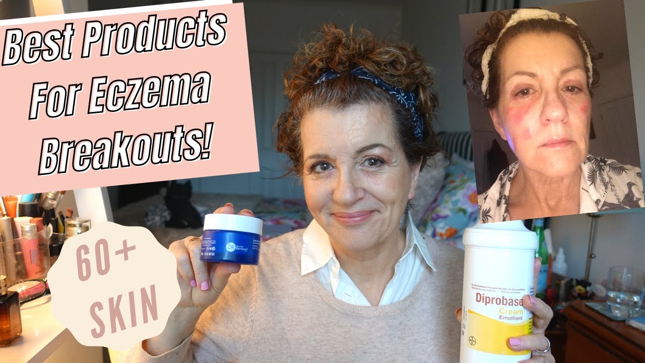 How I Cure Eczema On My Face and Eyelids// Eczema breakout with mature
