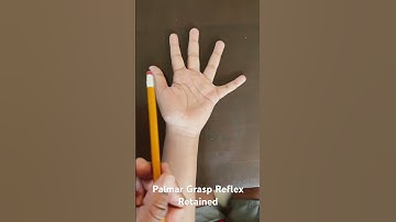 Primitive Reflexes- Palmar Grasp Reflex Retained