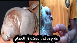 العلاج اليدوي لمرض الروشة شرح سهل جداً (الحلقه الرابعه) 