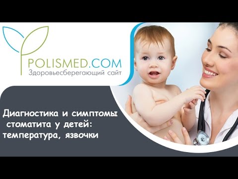 Как проводят диагностику при стоматите?