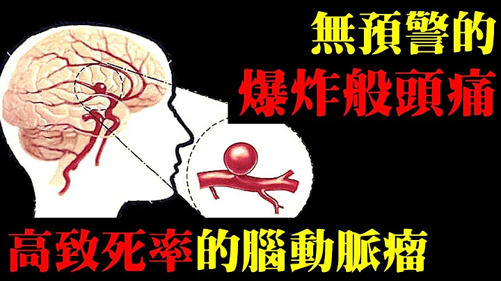 无预警的“爆炸般头痛”，高致死率的脑动脉瘤｜许原彰医师：高雄宇成诊所 - 天天要闻