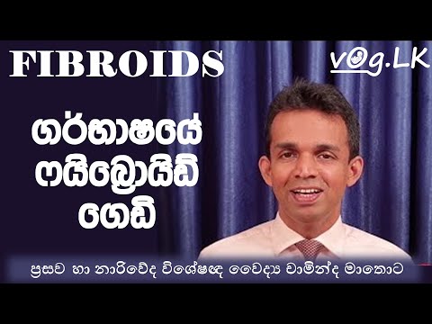 Fibroids. ෆයිබ්‍රොයිඩ් ගෙඩි ගැන VOG.LK වෛද්‍ය හමුව. විශේෂඥ වෛද්‍ය චාමින්ද මාතොට