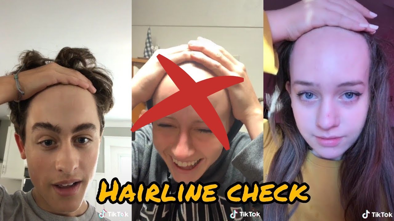 Hairline Check TikTok Compilation | TikTok Trend | New Trending Video ...