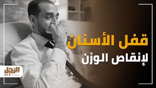 قفل الأسنان.. جهاز للقضاء على السمنة