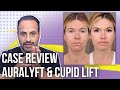 Case Review: Comprehensive AuraLyft & Cupid Lift | Lesson Of The Day