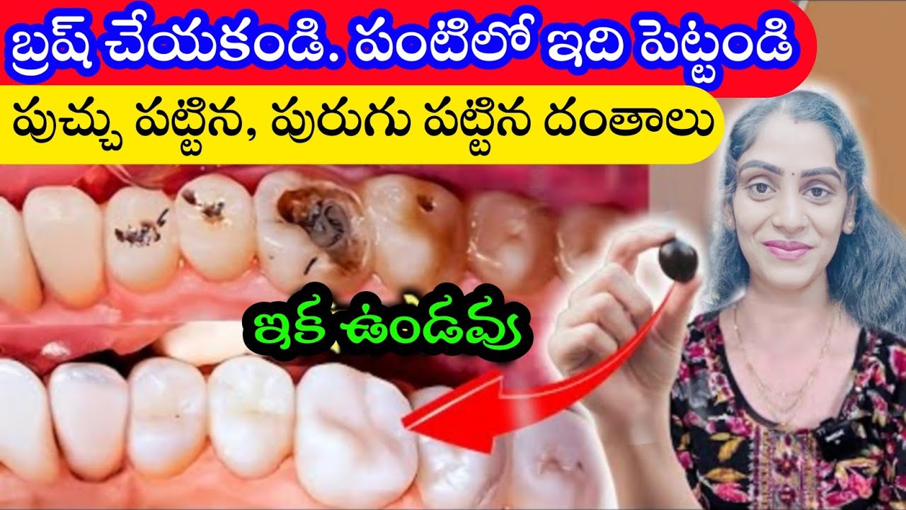 పుచ్చు పట్టిన పళ్ళు, దంత క్షయం ఇక మీకు ఉండవు దీన్ని ఒక్కసారి ట్రై చేయండి | teeth pain reduce