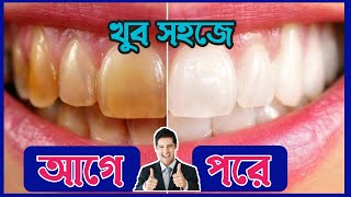 দাঁত পরিষ্কার করার সহজ উপায়। হলুদ দাঁত সাদা করার উপায়। Teeth whitening home remedy।Health Tips screenshot 4