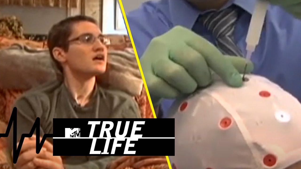 Plötzlich ist alles anders! Spätfolgen eines Schädelhirntraumas!| 2/2 | True Life | MTV Deutschland