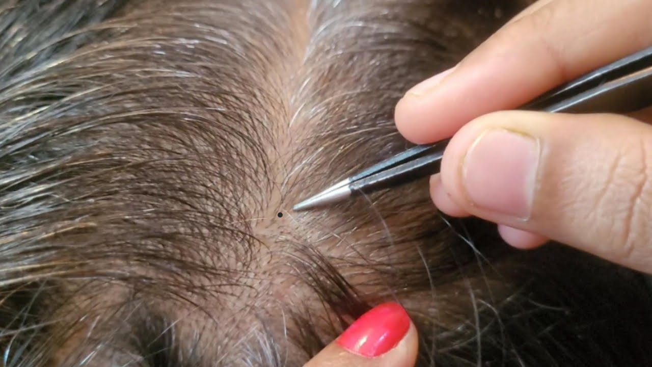 Scalp Check ASMR - Personal Attention Roleplay