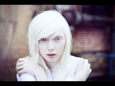 Video: De Ce Se Nasc Oamenii Albinoși?
