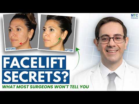 Facelift in Buenos Aires, Argentina: A Surgeon With 23+ Years Expereince Answers Everything!